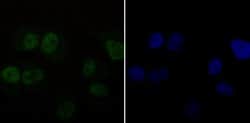 Invitrogen DDB1 Recombinant Rabbit Monoclonal Antibody (JU32-35) 100 &mu;L;