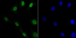 Invitrogen DDB1 Recombinant Rabbit Monoclonal Antibody (JU32-35) 100 &mu;L;
