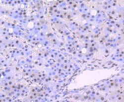 Invitrogen DDB1 Recombinant Rabbit Monoclonal Antibody (JU32-35) 100 &mu;L;