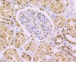 Invitrogen DDB1 Recombinant Rabbit Monoclonal Antibody (JU32-35) 100 &mu;L;