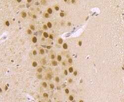 Invitrogen DDB1 Recombinant Rabbit Monoclonal Antibody (JU32-35) 100 &mu;L;