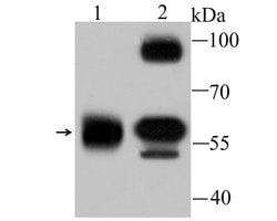 Invitrogen alpha Internexin Recombinant Rabbit Monoclonal Antibody (JU25-03)
