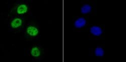 Invitrogen SAMHD1 Recombinant Rabbit Monoclonal Antibody (JU56-04) 100