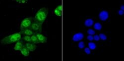 Invitrogen SAMHD1 Recombinant Rabbit Monoclonal Antibody (JU56-04) 100