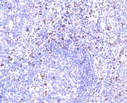 Invitrogen SAMHD1 Recombinant Rabbit Monoclonal Antibody (JU56-04) 100