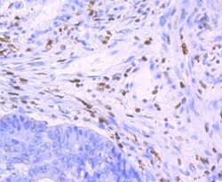 Invitrogen SAMHD1 Recombinant Rabbit Monoclonal Antibody (JU56-04) 100