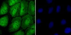 Invitrogen NUP153 Recombinant Rabbit Monoclonal Antibody (JU40-41) 100