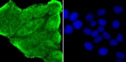 Invitrogen NUP153 Recombinant Rabbit Monoclonal Antibody (JU40-41) 100