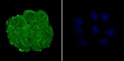Invitrogen NUP153 Recombinant Rabbit Monoclonal Antibody (JU40-41) 100