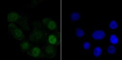 Invitrogen Histone H1.2 Recombinant Rabbit Monoclonal Antibody (JU43-48) 100 &mu;L | Buy Online | Invitrogen&trade; | Fisher Scientific