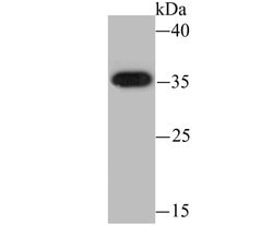 Invitrogen HSD11B1 Recombinant Rabbit Monoclonal Antibody (JU18-39) 100