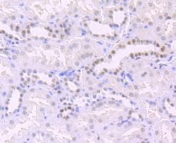 Invitrogen H3K14ac Recombinant Rabbit Monoclonal Antibody (JU43-26), ChIP-Verified 100 &mu;L | Buy Online | Invitrogen&trade; | Fisher Scientific