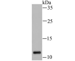 Invitrogen H3K14ac Recombinant Rabbit Monoclonal Antibody (JU43-26), ChIP-Verified 100 &mu;L | Buy Online | Invitrogen&trade; | Fisher Scientific