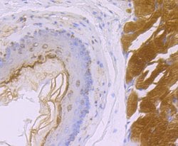 Invitrogen SDHB Recombinant Rabbit Monoclonal Antibody (JU02-33) 100 &mu;L;