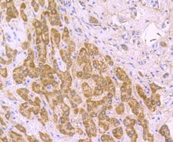 Invitrogen SDHB Recombinant Rabbit Monoclonal Antibody (JU02-33) 100 &mu;L;