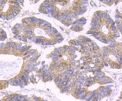 Invitrogen SDHB Recombinant Rabbit Monoclonal Antibody (JU02-33) 100 &mu;L;
