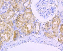 Invitrogen SDHB Recombinant Rabbit Monoclonal Antibody (JU02-33) 100 &mu;L;