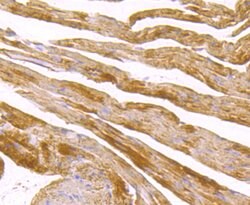 Invitrogen SDHB Recombinant Rabbit Monoclonal Antibody (JU02-33) 100 &mu;L;