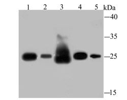 Invitrogen SDHB Recombinant Rabbit Monoclonal Antibody (JU02-33) 100 &mu;L;