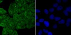 Invitrogen Drosha Recombinant Rabbit Monoclonal Antibody (JU33-01) 100
