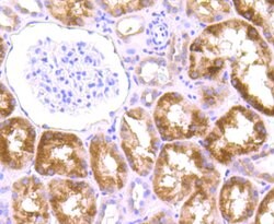 Invitrogen Drosha Recombinant Rabbit Monoclonal Antibody (JU33-01) 100