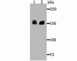Invitrogen Drosha Recombinant Rabbit Monoclonal Antibody (JU33-01) 100
