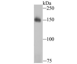 Invitrogen Drosha Recombinant Rabbit Monoclonal Antibody (JU33-01) 100