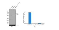 Invitrogen TGM2 Recombinant Rabbit Monoclonal Antibody (JU30-02) 100 &mu;L;