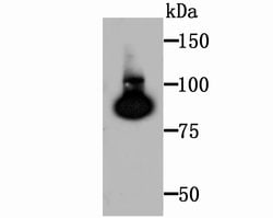 Invitrogen TGM2 Recombinant Rabbit Monoclonal Antibody (JU30-02) 100 &mu;L;