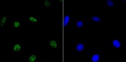Invitrogen HDAC9 Recombinant Rabbit Monoclonal Antibody (JU30-44) 100 &mu;L | Buy Online | Invitrogen&trade; | Fisher Scientific