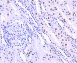 Invitrogen HDAC9 Recombinant Rabbit Monoclonal Antibody (JU30-44) 100 &mu;L | Buy Online | Invitrogen&trade; | Fisher Scientific