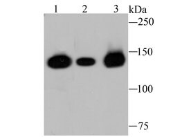Invitrogen HDAC9 Recombinant Rabbit Monoclonal Antibody (JU30-44) 100 &mu;L | Buy Online | Invitrogen&trade; | Fisher Scientific