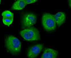 Invitrogen USP14 Recombinant Rabbit Monoclonal Antibody (JU30-49) 100 &mu;L;
