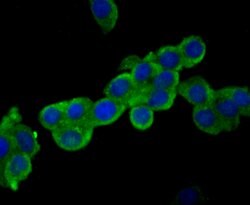 Invitrogen USP14 Recombinant Rabbit Monoclonal Antibody (JU30-49) 100 &mu;L;