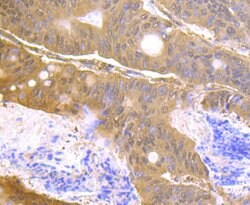 Invitrogen USP14 Recombinant Rabbit Monoclonal Antibody (JU30-49) 100 &mu;L;