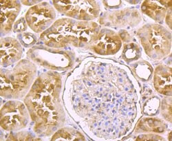 Invitrogen USP14 Recombinant Rabbit Monoclonal Antibody (JU30-49) 100 &mu;L;