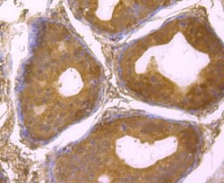Invitrogen USP14 Recombinant Rabbit Monoclonal Antibody (JU30-49) 100 &mu;L;