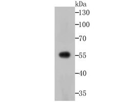 Invitrogen USP14 Recombinant Rabbit Monoclonal Antibody (JU30-49) 100 &mu;L;