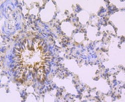 Invitrogen MAD2L2 Recombinant Rabbit Monoclonal Antibody (JU99-23) 100