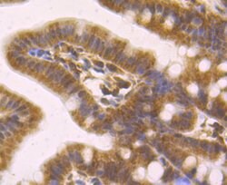 Invitrogen MAD2L2 Recombinant Rabbit Monoclonal Antibody (JU99-23) 100