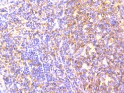 Invitrogen MAD2L2 Recombinant Rabbit Monoclonal Antibody (JU99-23) 100