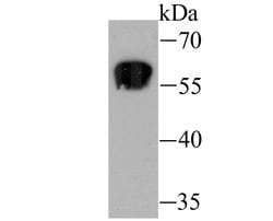 Invitrogen Staufen Recombinant Rabbit Monoclonal Antibody (JU30-85) 100