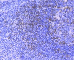 Invitrogen Zap-70 Recombinant Rabbit Monoclonal Antibody (JU08-39) 100