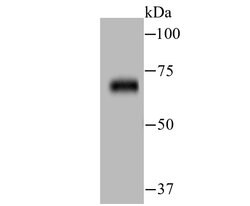 Invitrogen Zap-70 Recombinant Rabbit Monoclonal Antibody (JU08-39) 100