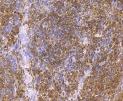 Invitrogen p23 Recombinant Rabbit Monoclonal Antibody (JU09-31) 100 &mu;L;