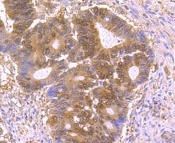 Invitrogen p23 Recombinant Rabbit Monoclonal Antibody (JU09-31) 100 &mu;L;