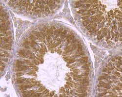 Invitrogen p23 Recombinant Rabbit Monoclonal Antibody (JU09-31) 100 &mu;L;