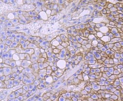Invitrogen alpha-II Spectrin Recombinant Rabbit Monoclonal Antibody (JU32-09)