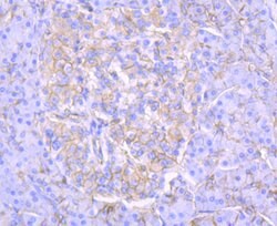 Invitrogen alpha-II Spectrin Recombinant Rabbit Monoclonal Antibody (JU32-09)