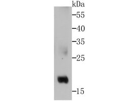 Invitrogen GPX4 Recombinant Rabbit Monoclonal Antibody (JU11-31) 100 &mu;L | Buy Online | Invitrogen&trade; | Fisher Scientific